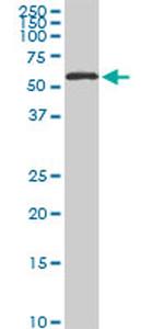 HDAC1 Antibody in Western Blot (WB)