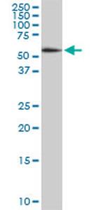 HDAC1 Antibody in Western Blot (WB)