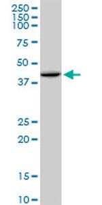 HFE Antibody in Western Blot (WB)