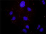 HGF Antibody in Proximity Ligation Assay (PLA) (PLA)