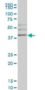 HHEX Antibody in Western Blot (WB)