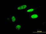 HIC1 Antibody in Immunocytochemistry (ICC/IF)