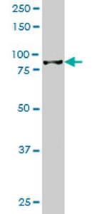 HIC1 Antibody in Western Blot (WB)