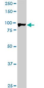 HIC1 Antibody in Western Blot (WB)