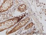 HIP1 Antibody in Immunohistochemistry (Paraffin) (IHC (P))