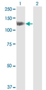 HIP1 Antibody in Western Blot (WB)