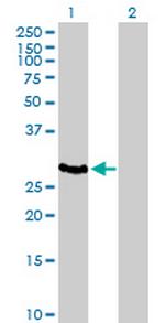 HLA-DOA Antibody in Western Blot (WB)