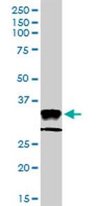 HLA-DPA1 Antibody in Western Blot (WB)