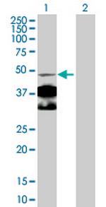 NR4A1 Antibody in Western Blot (WB)