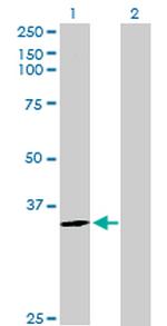 HNMT Antibody in Western Blot (WB)