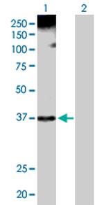 HNRNPA1 Antibody in Western Blot (WB)