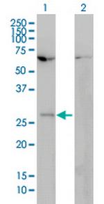 HOXB7 Antibody in Western Blot (WB)