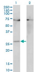 HOXB7 Antibody in Western Blot (WB)