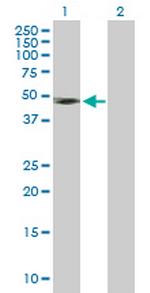 IFNGR2 Antibody in Western Blot (WB)