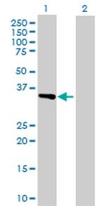 ITGAV Antibody in Western Blot (WB)