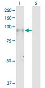 ITGB7 Antibody in Western Blot (WB)