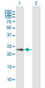 KLRC2 Antibody in Western Blot (WB)