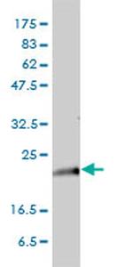 KRAS Antibody in Western Blot (WB)