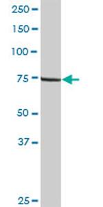 LIMK2 Antibody in Western Blot (WB)