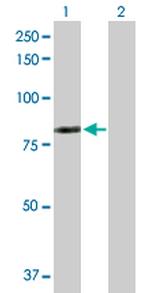 LIMK2 Antibody in Western Blot (WB)