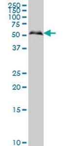 SMAD1 Antibody in Western Blot (WB)