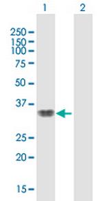 SMAD9 Antibody in Western Blot (WB)