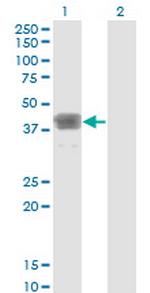 MAGEB1 Antibody in Western Blot (WB)