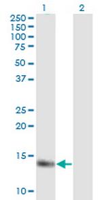 MB Antibody in Western Blot (WB)