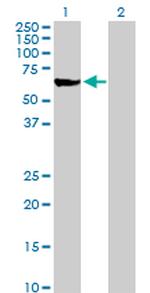 ME1 Antibody in Western Blot (WB)