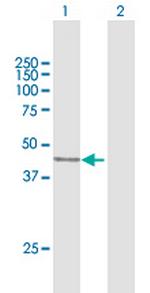 MEIS1 Antibody in Western Blot (WB)