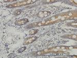 MAP3K4 Antibody in Immunohistochemistry (Paraffin) (IHC (P))