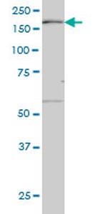 MAP3K4 Antibody in Western Blot (WB)