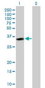 MSX2 Antibody in Western Blot (WB)