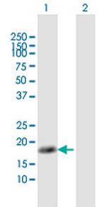 NUDT1 Antibody in Western Blot (WB)