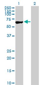 MYBPH Antibody in Western Blot (WB)