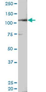 NEDD9 Antibody in Western Blot (WB)