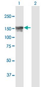 NFKBIL2 Antibody in Western Blot (WB)