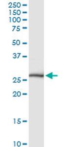 NKX3-1 Antibody in Western Blot (WB)