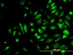 NME2 Antibody in Immunocytochemistry (ICC/IF)