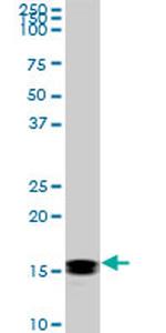 NME2 Antibody in Western Blot (WB)