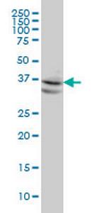 NODAL Antibody in Western Blot (WB)