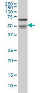 NOVA1 Antibody in Western Blot (WB)