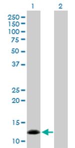 NPPB Antibody in Western Blot (WB)