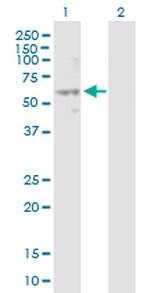 NPY1R Antibody in Western Blot (WB)