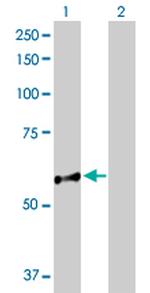 NUP98 Antibody in Western Blot (WB)