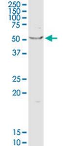 OXCT1 Antibody in Western Blot (WB)