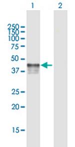 P2RY2 Antibody in Western Blot (WB)