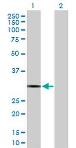 PDYN Antibody in Western Blot (WB)