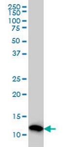 PFN2 Antibody in Western Blot (WB)