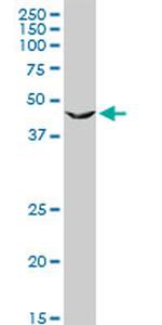 PGD Antibody in Western Blot (WB)